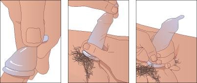 How To Use A Condom